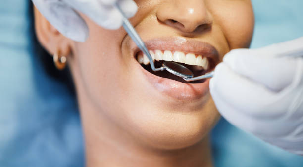 Best Emergency Treatment for Dental Infections or Abscesses in Progreso, TX